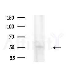Cyclin C Antibody - Western blot analysis of extracts from HUVEC cells(LPS,4h treatment), using Cyclin C Antibody at 1/1000 dilution.