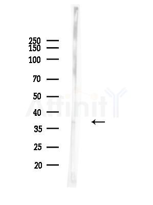 Cyclin C Antibody - Western blot analysis of lysates from HUVEC cells(LPS,4h treatment), using Cyclin C Antibody at 1/1000 dilution.