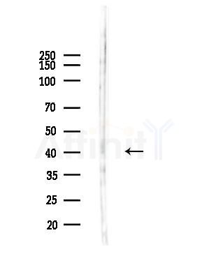 CCNG2 Antibody - Western blot analysis of lysates from HUVEC cells(LPS,4h treatment), using CCNG2 Antibody at 1/1000 dilution.