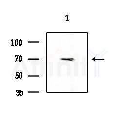 CCNK Antibody - Western blot analysis of extracts from EC304 cells, using CCNK Antibody at 1/1000 dilution.