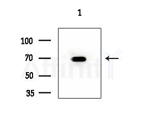 CCNK Antibody - Western blot analysis of extracts from COLO205 cells, using CCNK Antibody at 1/1000 dilution.