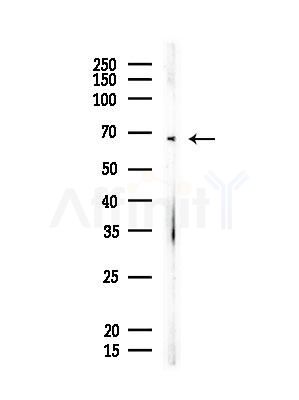CCNK Antibody - Western blot analysis of lysates from EC304 cells, using CCNK Antibody at 1/1000 dilution.