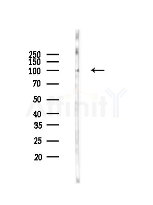 CD166 Antibody - Western blot analysis of lysates from Rat lung, using CD166 Antibody at 1/1000 dilution.