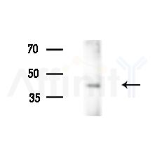 CD177 Antibody - Western blot analysis of extracts from HUVEC cells(LPS,4h treatment), using CD177 Antibody at 1/1000 dilution.