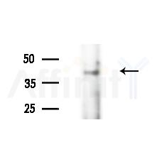 CD177 Antibody - Western blot analysis of extracts from LoVo cells(heat-shock,45min treatment), using CD177 Antibody at 1/1000 dilution.
