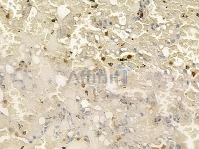 CD177 Antibody - DF2293 at 1/100 staining human normal lung tissue by IHC-P.