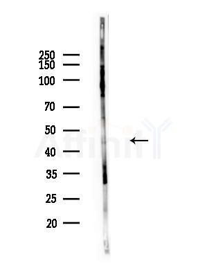 CD177 Antibody - Western blot analysis of lysates from HUVEC cells(LPS,4h treatment), using CD177 Antibody at 1/1000 dilution.