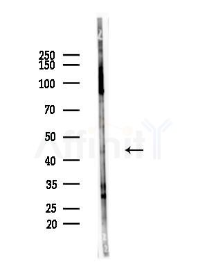 CD177 Antibody - Western blot analysis of lysates from LoVo cells(heat-shock,45min treatment), using CD177 Antibody at 1/1000 dilution.