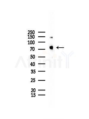 CD2AP Antibody - Western blot analysis of lysates from COLO205 cells, using CD2AP Antibody at 1/1000 dilution.