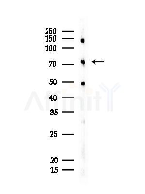 CD2AP Antibody - Western blot analysis of lysates from EC304 cells, using CD2AP Antibody at 1/1000 dilution.