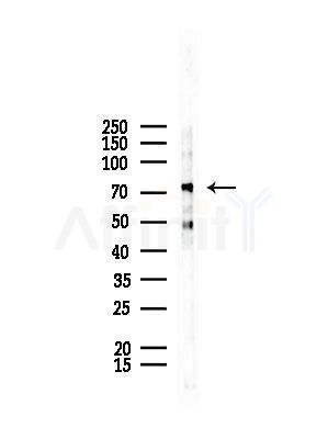 CD2AP Antibody - Western blot analysis of lysates from Rat testis, using CD2AP Antibody at 1/1000 dilution.