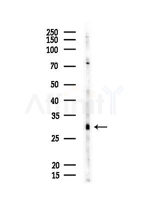 CD48 Antibody - Western blot analysis of lysates from EC304 cells, using CD48 Antibody at 1/1000 dilution.