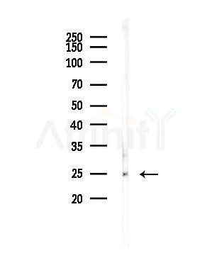 CD63 Antibody - Western blot analysis of lysates from Rat testis, using CD63 Antibody at 1/1000 dilution.