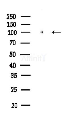 CD97 Antibody - Western blot analysis of lysates from Rat brain, using CD97 Antibody at 1/1000 dilution.