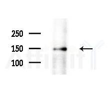 CENPJ Antibody - Western blot analysis of extracts from HUVEC cells(LPS,4h treatment), using CENPJ Antibody at 1/1000 dilution.
