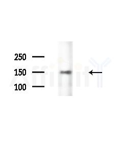 CENPJ Antibody - Western blot analysis of extracts from LoVo cells(heat-shock,45min treatment), using CENPJ Antibody at 1/1000 dilution.