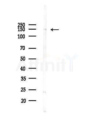 CENPJ Antibody - Western blot analysis of lysates from HUVEC cells(LPS,4h treatment), using CENPJ Antibody at 1/1000 dilution.