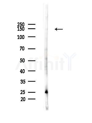 CENPJ Antibody - Western blot analysis of lysates from LoVo cells(heat-shock,45min treatment), using CENPJ Antibody at 1/1000 dilution.
