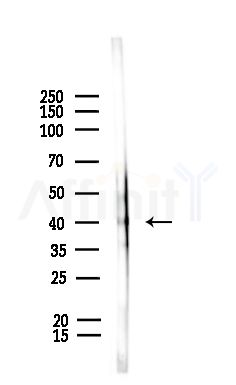 CENPL Antibody - Western blot analysis of lysates from Rat liver, using CENPL Antibody at 1/1000 dilution.