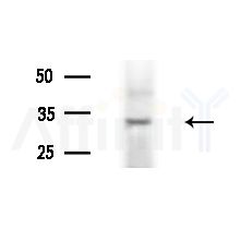 CENPO Antibody - Western blot analysis of extracts from HUVEC cells(LPS,4h treatment), using CENPO Antibody at 1/1000 dilution.