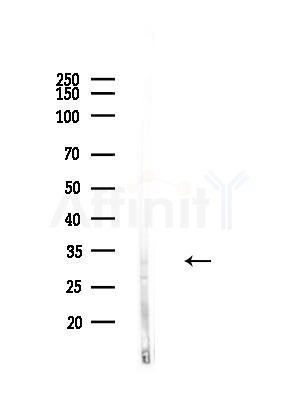 CENPO Antibody - Western blot analysis of lysates from HUVEC cells(LPS,4h treatment), using CENPO Antibody at 1/1000 dilution.