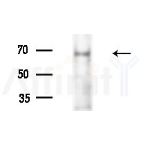CENPT Antibody - Western blot analysis of extracts from LoVo cells(heat-shock,45min treatment), using CENPT Antibody at 1/1000 dilution.