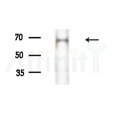 CENPT Antibody - Western blot analysis of extracts from Rat brain, using CENPT Antibody at 1/1000 dilution.