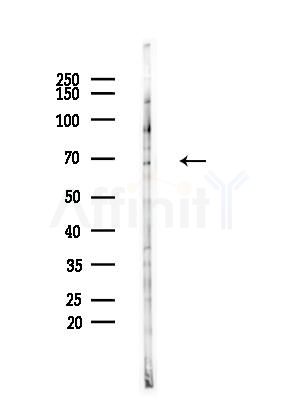 CENPT Antibody - Western blot analysis of lysates from LoVo cells(heat-shock,45min treatment), using CENPT Antibody at 1/1000 dilution.
