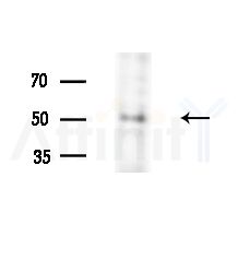 CENPU Antibody - Western blot analysis of extracts from HUVEC cells(LPS,4h treatment), using CENPU Antibody at 1/1000 dilution.