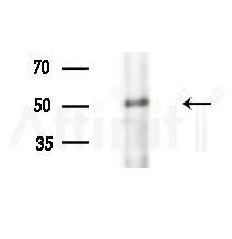 CENPU Antibody - Western blot analysis of extracts from LoVo cells(heat-shock,45min treatment), using CENPU Antibody at 1/1000 dilution.