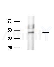 CENPU Antibody - Western blot analysis of extracts from Rat brain, using CENPU Antibody at 1/1000 dilution.