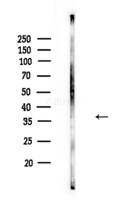 CXCR5 Antibody - Western blot analysis of lysates from Rat brain, using CXCR5 Antibody at 1/1000 dilution.