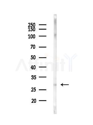 FA58A Antibody - Western blot analysis of lysates from EC304 cells(heat-shock,45min treatment), using FA58A Antibody at 1/1000 dilution.
