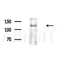 JIP4 Antibody - Western blot analysis of extracts from HUVEC cells(LPS,4h treatment), using JIP4 Antibody at 1/1000 dilution.