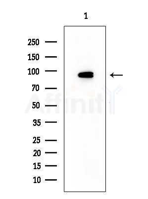 MAGD4 Antibody - Western blot analysis of extracts from HUVEC cells, using MAGD4 Antibody at 1/1000 dilution.