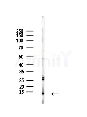 LAMTOR3 Antibody - Western blot analysis of lysates from Rat lung, using LAMTOR3 Antibody at 1/1000 dilution.