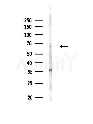 RAD9B Antibody - Western blot analysis of lysates from MDA-MB-231 cells(heat-shock,45min treatment), using RAD9B Antibody at 1/1000 dilution.