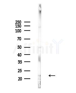 SIVA Antibody - Western blot analysis of lysates from Hela cells(UV,30min treatment), using SIVA Antibody at 1/1000 dilution.