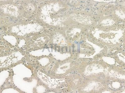 SIVA Antibody - DF2366 at 1/100 staining human normal kidney tissue by IHC-P.