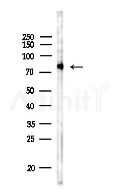 TAB3 Antibody - Western blot analysis of lysates from LoVo cells(heat-shock,45min treatment), using TAB3 Antibody at 1/1000 dilution.