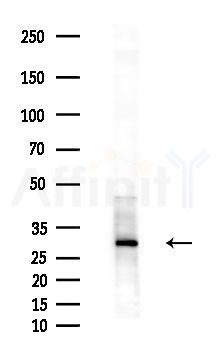 GADD45A Antibody - Western blot analysis of extracts from various samples, using GADD45A Antibody at 1/1000 dilution.