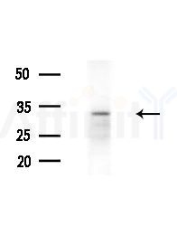 GADD45A Antibody - Western blot analysis of extracts from EC304 cells
(heat-shock treatment), using GADD45A Antibody at 1/1000 dilution.