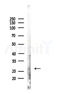 Granzyme K Antibody - Western blot analysis of lysates from Hela cells(LPS,4h treatment), using Granzyme K Antibody at 1/1000 dilution.