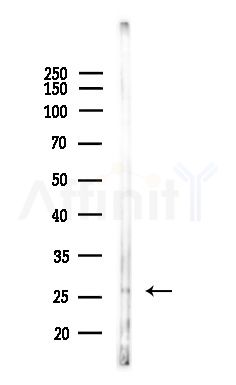 GZMM Antibody - Western blot analysis of lysates from LoVo cells(heat-shock,45min treatment), using GZMM Antibody at 1/1000 dilution.