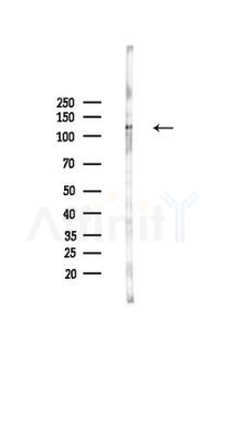 MSH3 Antibody - Western blot analysis of lysates from HUVEC cells(UV,30min treatment), using MSH3 Antibody at 1/1000 dilution.