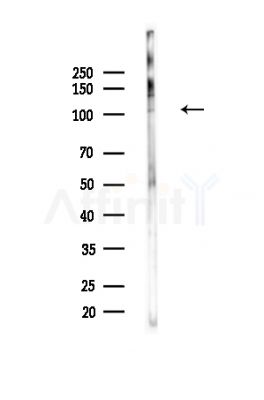 PMS1 Antibody - Western blot analysis of lysates from PC12 cells(UV,30min treatment), using PMS1 Antibody at 1/1000 dilution.