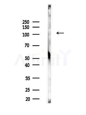 PMS1 Antibody - Western blot analysis of lysates from COLO205 cells(heat-shock,45min treatment), using PMS1 Antibody at 1/1000 dilution.