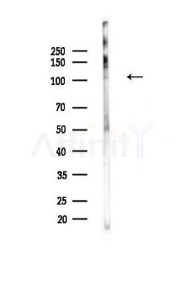 PMS1 Antibody - Western blot analysis of lysates from PC12 cells(UV,30min treatment), using PMS1 Antibody at 1/1000 dilution.