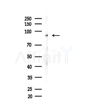 TB10B Antibody - Western blot analysis of lysates from Hela cells(heat-shock,45min treatment), using TB10B Antibody at 1/1000 dilution.
