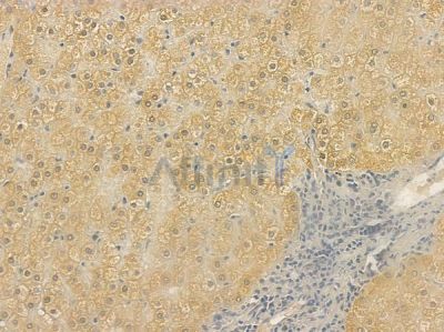TAF7L Antibody - DF2403 at 1/100 staining human normal liver tissue by IHC-P.